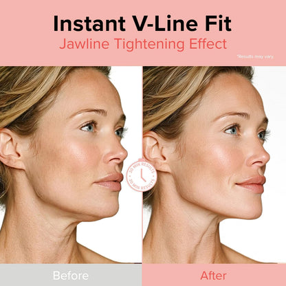 id FACE FIT MINUS BAND V2 (4ea)