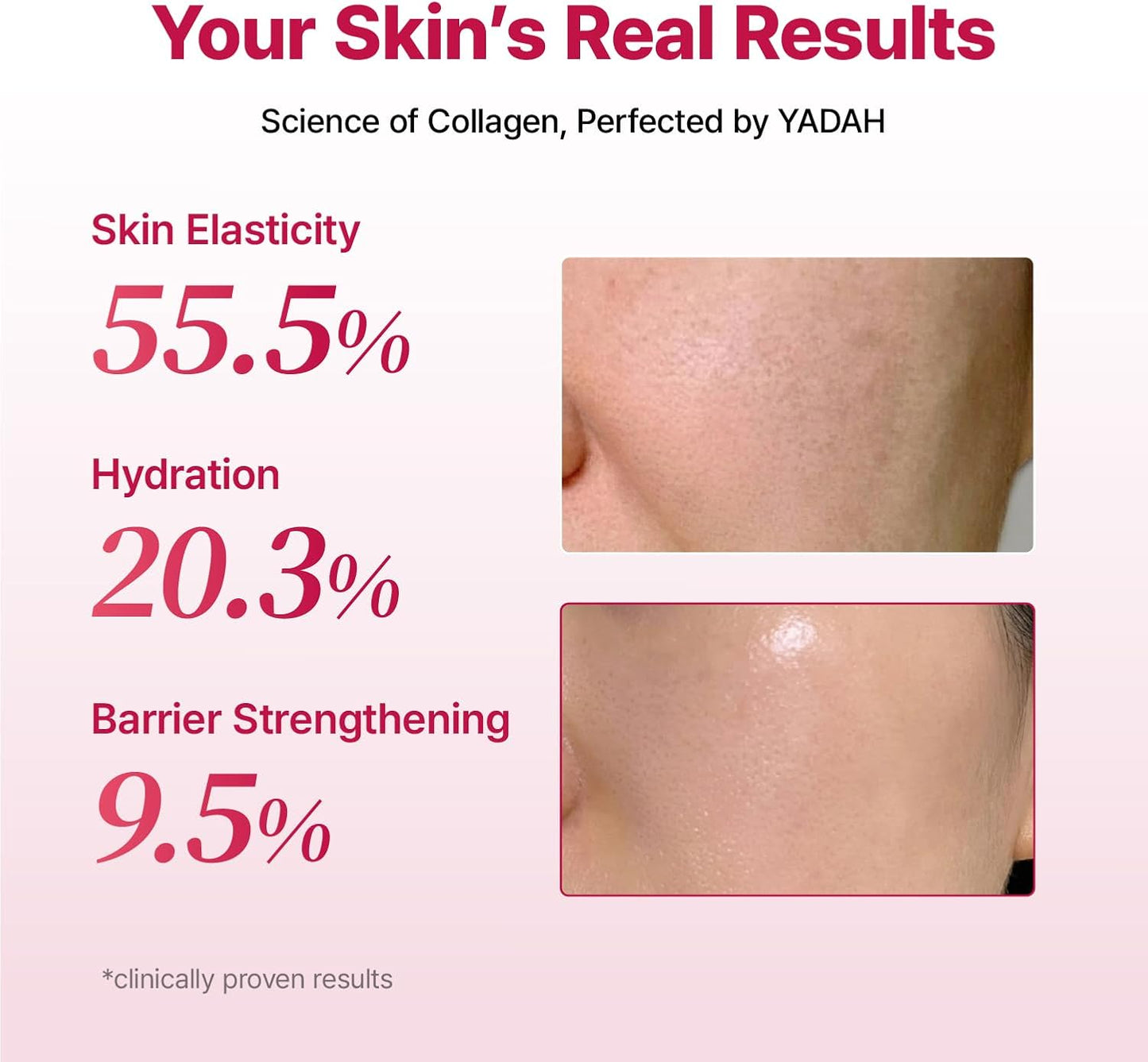 YADAH COLLAGEN HYDRA CORE CREAM