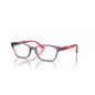 0VY2024 VOGUE JUNIOR OPHTHAL