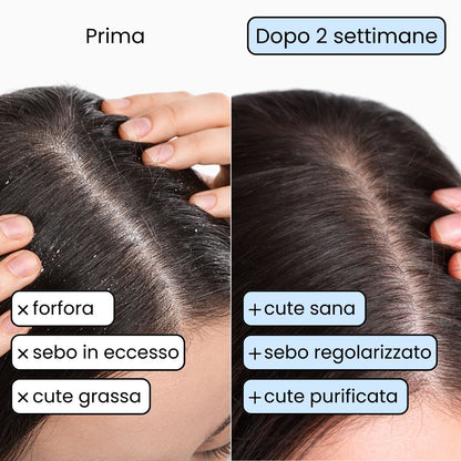 Set Solido Capelli Grassi – Purifica Senza Seccare