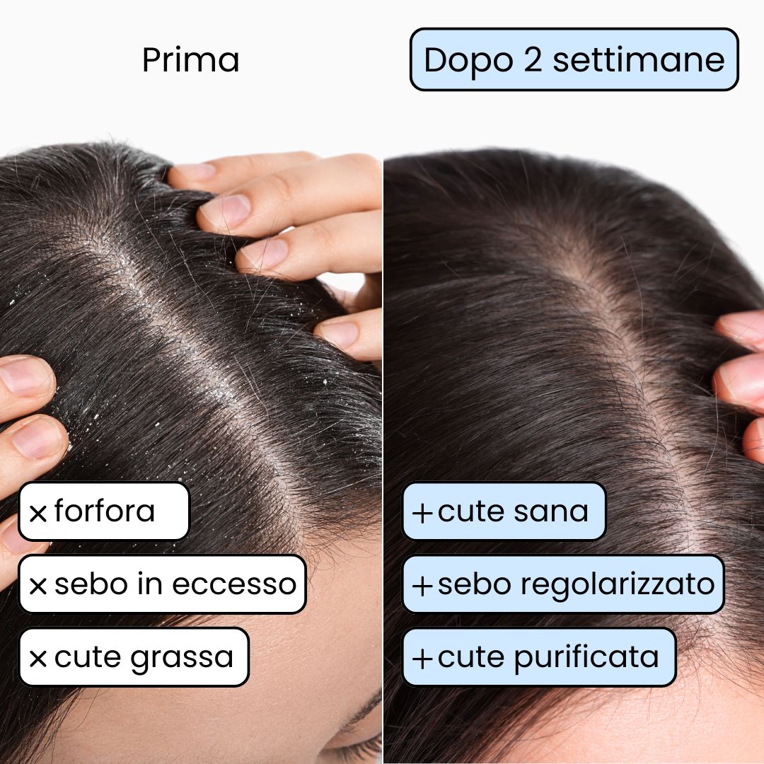 Shampoo Solido Purificante per capelli Grassi