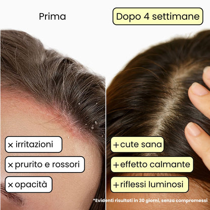 Shampoo Solido Lenitivo per cute Sensibile