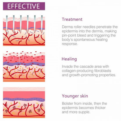 DERMA ROLLER 4 IN 1 PER IL CORPO VISO OCCHIO INTERCAMBIABILI SKINCARE AGOPUNTURA