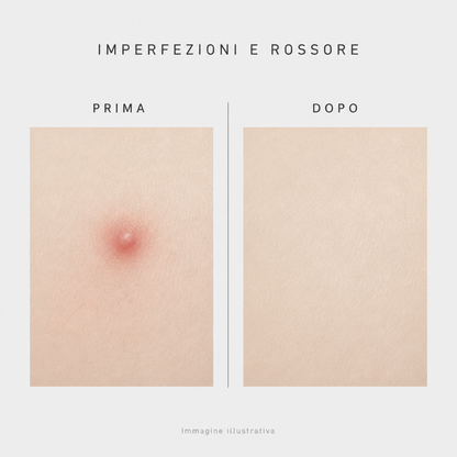 VT Cosmetics Cica Spot Patch – Cerotti Anti-Imperfezioni 48 pz